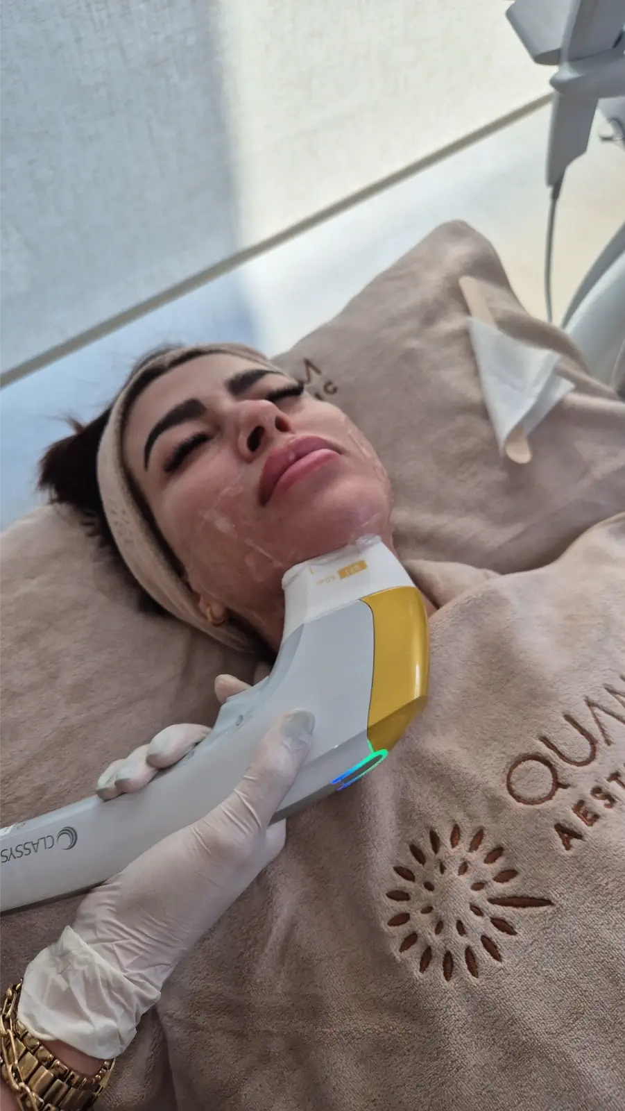 Ultraformer treatment under jaw