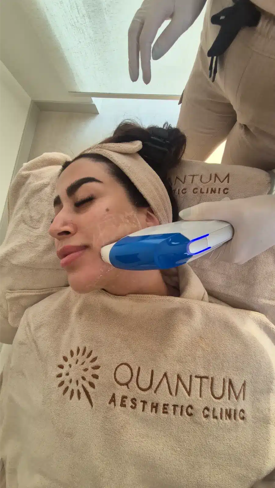 Ultraformer treatment on cheek